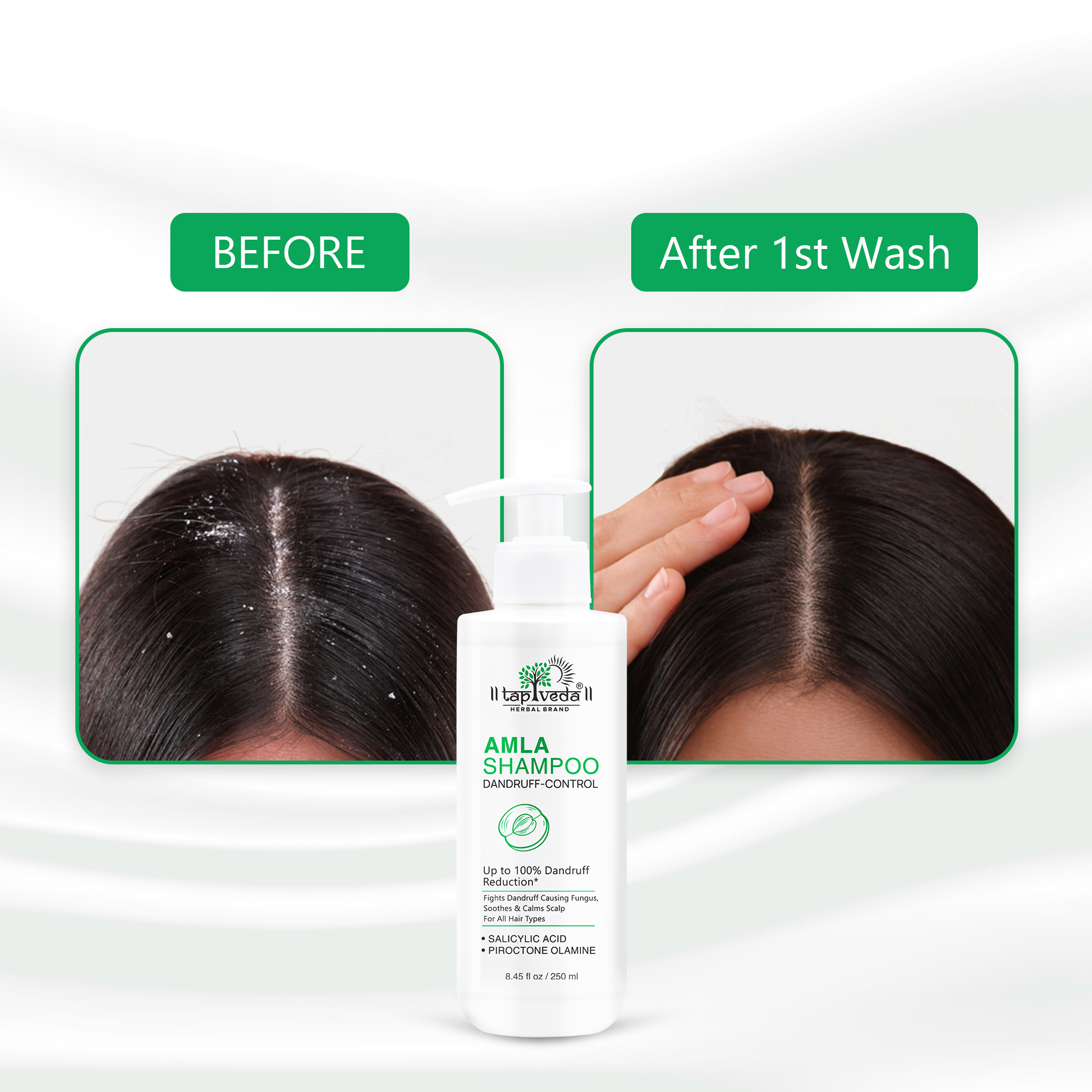 Refreshing Anti-Dandruff Shampoo with amla and piroctone olamine Tapveda