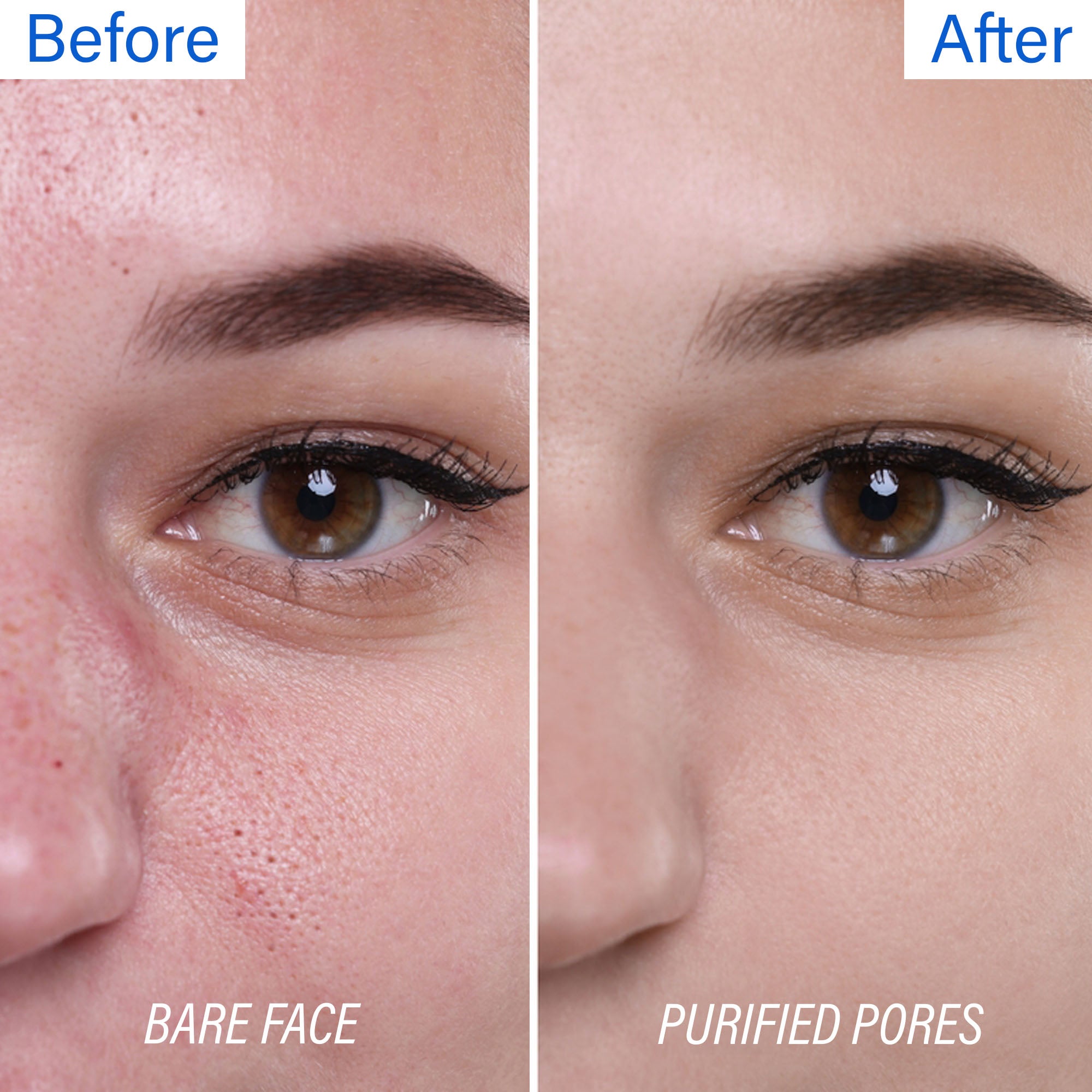 Tapveda Brazilian Blue Clay Face Mask – 100g | Brightens Skin, Removes Tan, Unclogs Pores & Reduces Blackheads