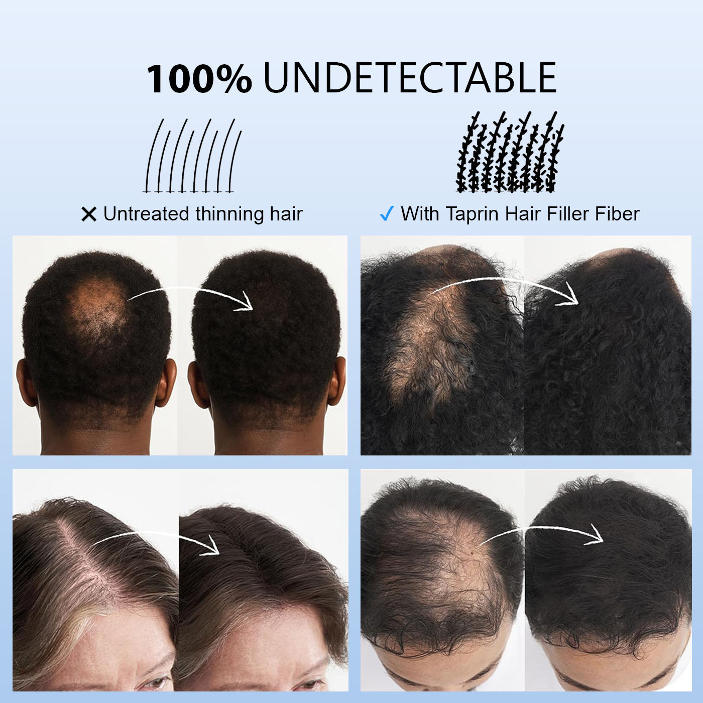 Taprin Hair Fiber with Fiber Hold Spray | Instant Keratin Hair Building Solution for Bald Spots & Thinning Hair – 20g + 100ml