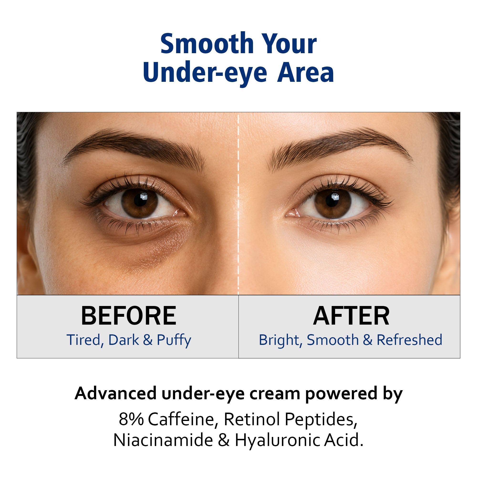 Under Eye Cream with Caffeine | Anti-Puffiness Hydrating Eye Cream with Retinol Peptides (15g)